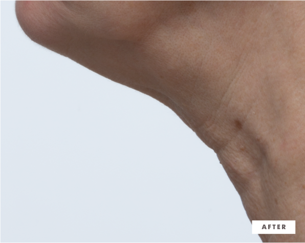 Necks-Level Smooth Triple Effect Neck Cream