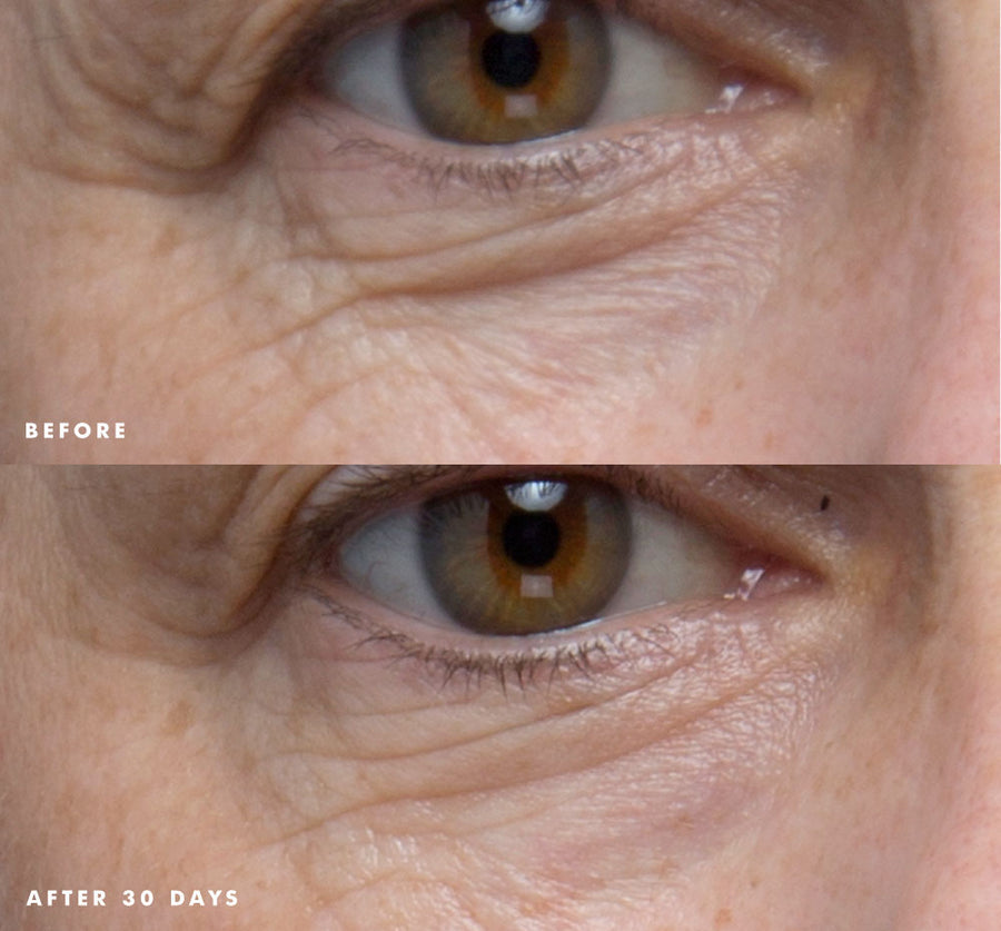 Lustre Rose® Serum-In-Oil